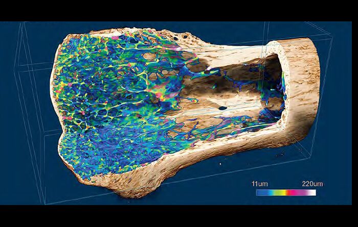 01-skyscan-1275-bone-01