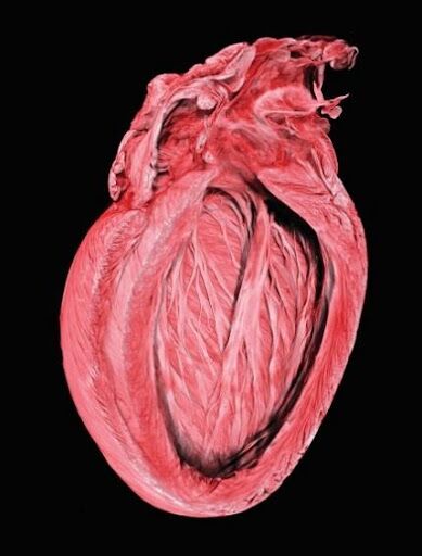 Soft tissue - heart Soft tissue - heart