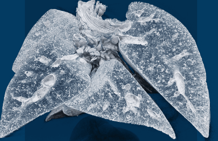 Mouse lungs Mouse lungs