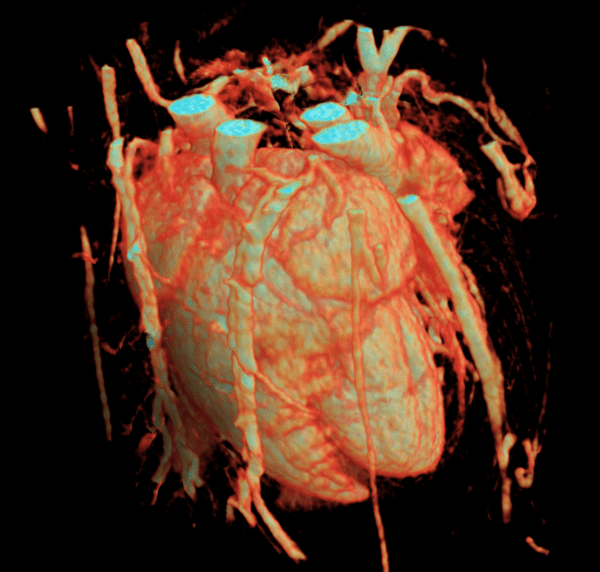 Cardiac 4D imaging Cardiac 4D imaging